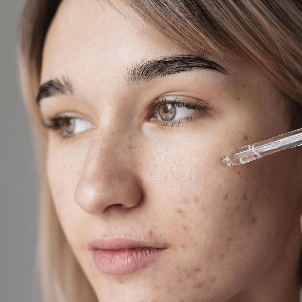 Organic Skin Spot Purifying Serum. Shop Skin Care on Mounteen. Worldwide shipping available.